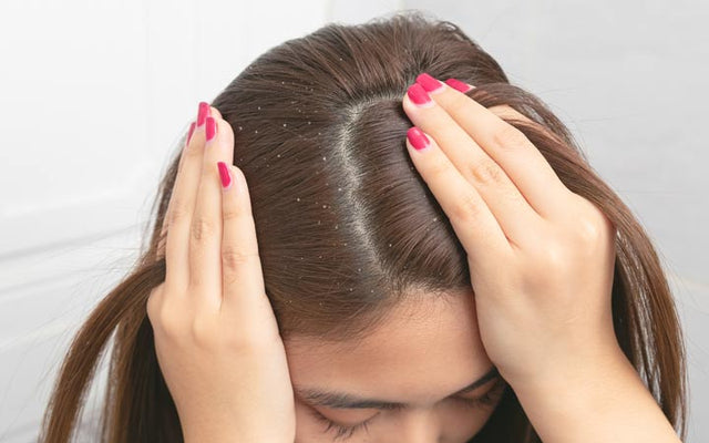 Dandruff Vs Psoriasis: What’s The Difference?