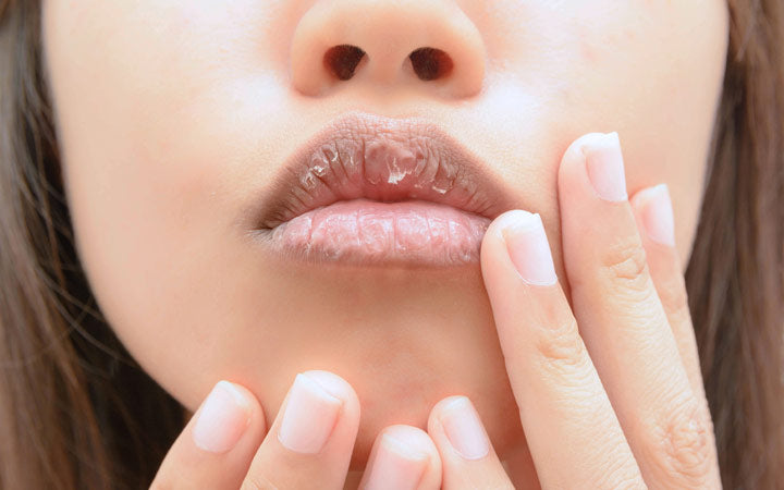 How Long Does Peeled Lip Skin Take to Heal  