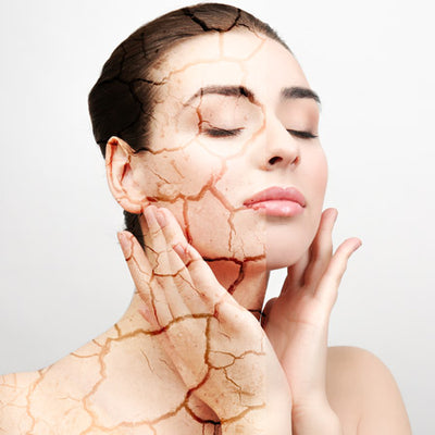 Dry vs Dehydrated Skin - Differences, Causes and Treatments