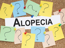 Alopecia Totalis: Symptoms, Causes, Treatments & Risk Factors