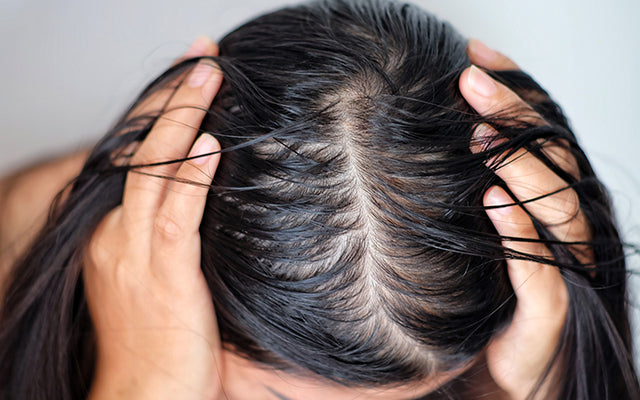 Oily Scalp With Dry Ends: Why & How To Control?
