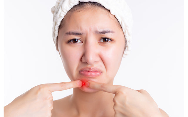 How To Treat A Blood-Filled Pimple On Your Face?