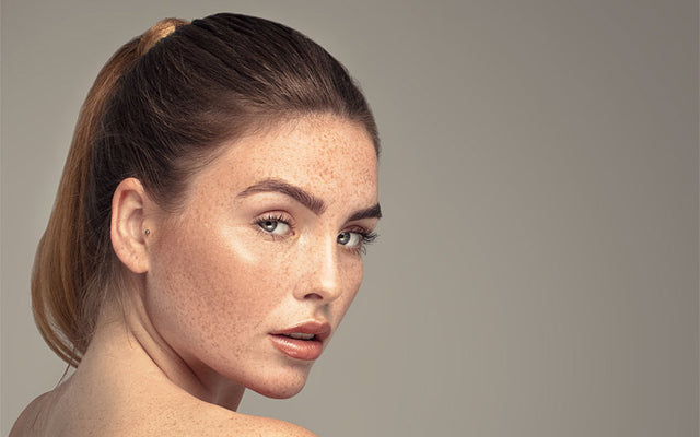 Freckles On Face & Body: What, Why, Removal & Prevention