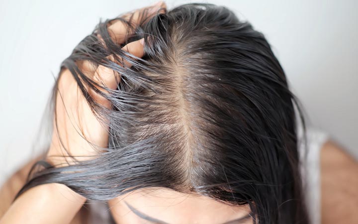 My hair is so thin I can see my scalp! Expert Advice & Reasons