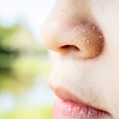 9 Reasons of Dry Skin Around Nose & How To Treat It?
