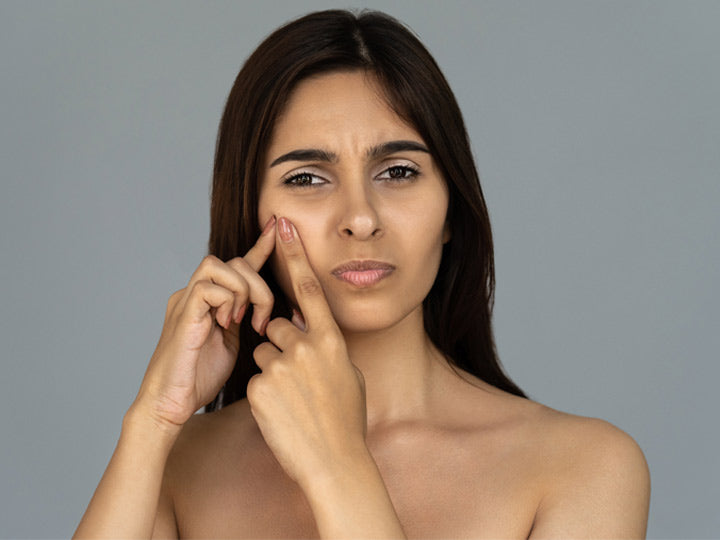 5 Causes Of White Spots On Face And How To Manage Them – SkinKraft