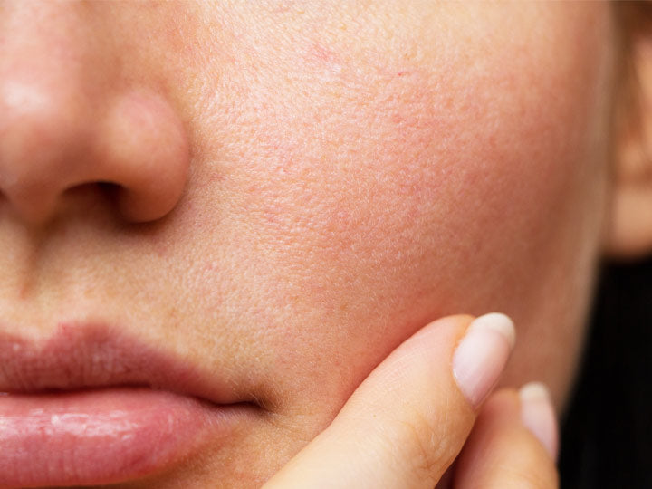 skin pore texture