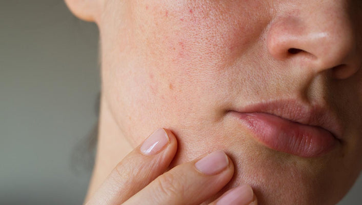 If You Have Sensitive Skin, This Is A Must-Read!