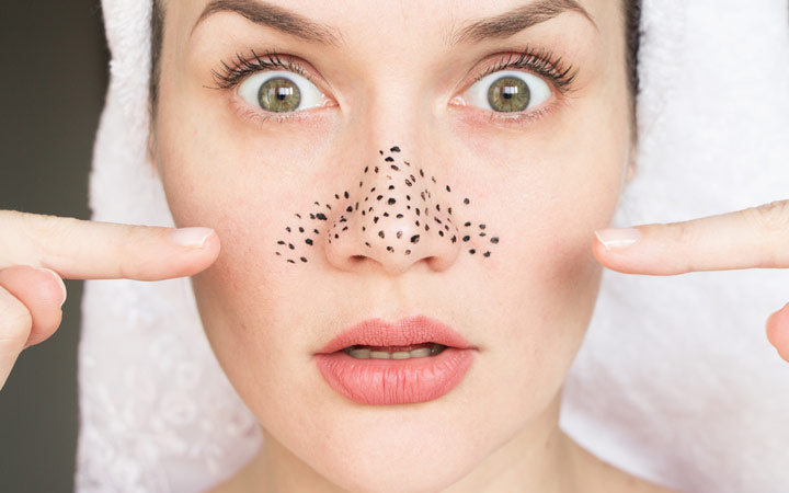 Puffy Eyes: Triggers, Treatments & Foods To Eat/Avoid – SkinKraft
