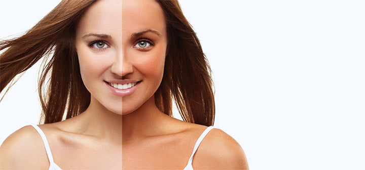 Summer is comingdo you know how to avoid white and dark spots