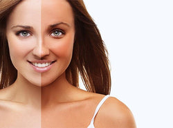 How To Remove Tan From Your Face and Skin?