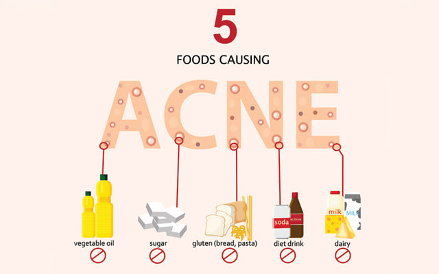 Acne Diet: 9 Foods That Cause Pimples(Plus Foods That Clear Them)