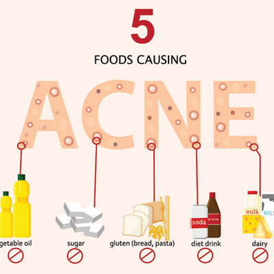 Acne Diet: 9 Foods That Cause Pimples(Plus Foods That Clear Them)