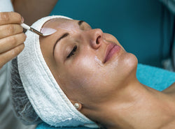 Chemical Peels: Everything You Have Ever Wanted To Know About Them