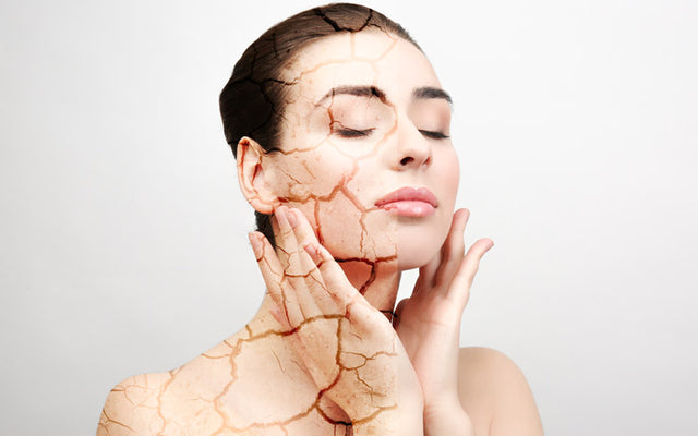 Dry vs Dehydrated Skin - Differences, Causes and Treatments