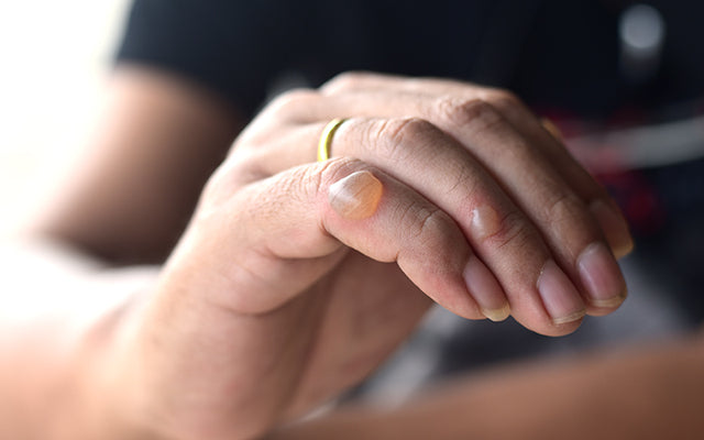 Ring Avulsion Injuries and Injury from Wedding Band