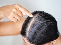 ऑयली बालों की देखभाल - Oily Hair Care Tips In Hindi
