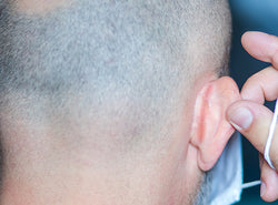 Dry Skin Behind The Ears: Causes, Treatment & Prevention