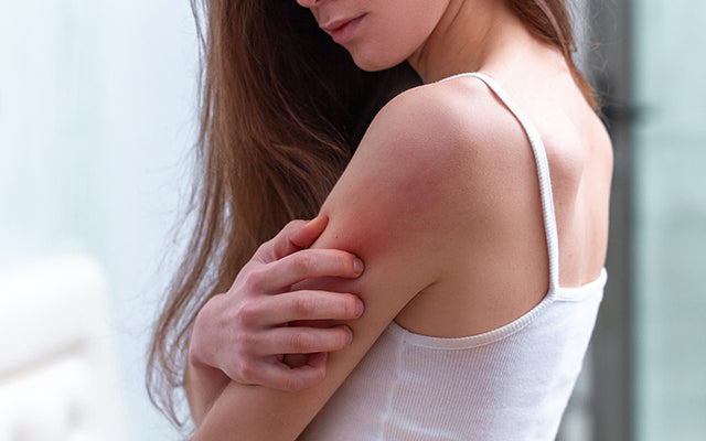 एक्जिमा यानी खुजली के लक्षण, कारण और  घरेलू इलाज - Eczema In Hindi