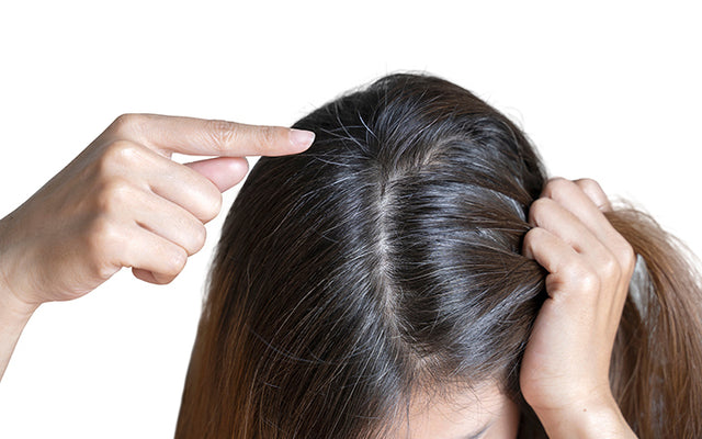 "White Hair : के कारण और प्राकृतिक उपाय: सफेद बालों को रोकने के लिए आसान तरीके"