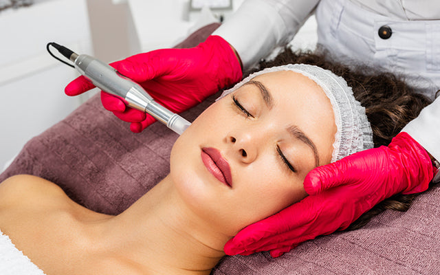 Microneedling: Procedure, Benefits, Dos & Don'ts