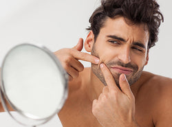8 Easy Ways To Get Rid of Beard Pimples