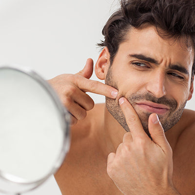 8 Easy Ways To Get Rid of Beard Pimples