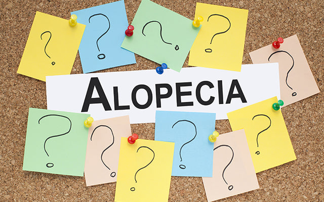 Alopecia Totalis: Symptoms, Causes, Treatments & Risk Factors