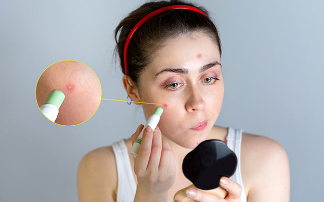 How I Cover My Facial Scars With Makeup