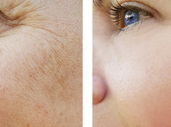9 Skin Rejuvenation Treatments That Can Make You Look Younger
