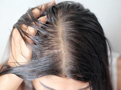 Greasy Hair Solutions You Should Try Right Away!