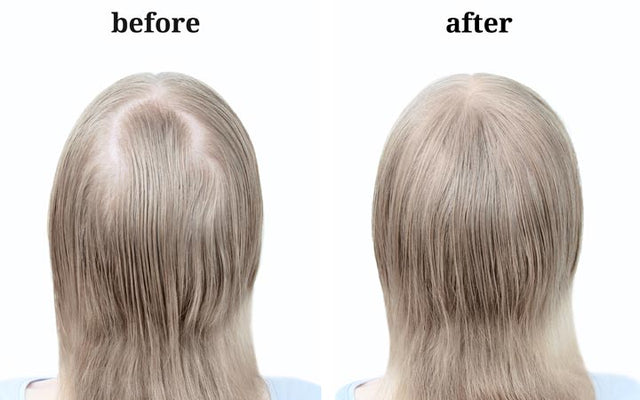 How To Increase Volume Of Hair  Be Beautiful India