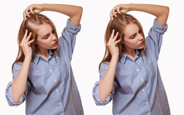Female Pattern Hair Loss: Why It Occurs, Who It Affects & How To Deal With It