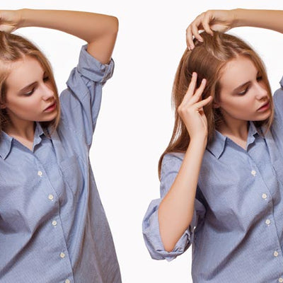 Female Pattern Hair Loss: Why It Occurs, Who It Affects & How To Deal With It