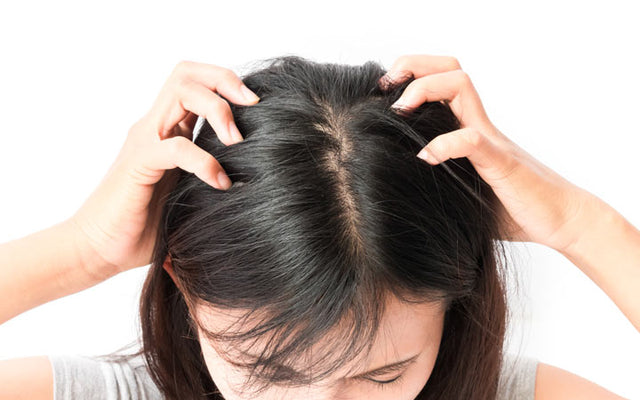 Head Lice: How To Get Rid Of Them With Simple Steps