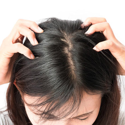 Head Lice: How To Get Rid Of Them With Simple Steps