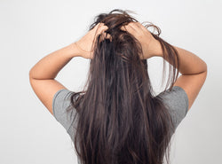 Itchy Scalp And Hair Loss: What Is The Relation Between Them?