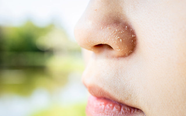 9 Reasons of Dry Skin Around Nose & How To Treat It?