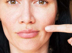 How to Treat Pimple On Lip : Causes + Prevention Tips