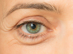 Puffy Eyes: Triggers, Treatments & Foods To Eat/Avoid