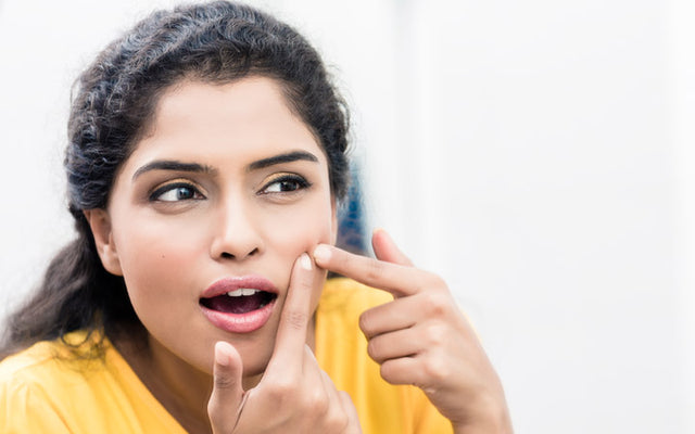 Skin Purging Or Acne? Know The Difference Before Opting For Treatments