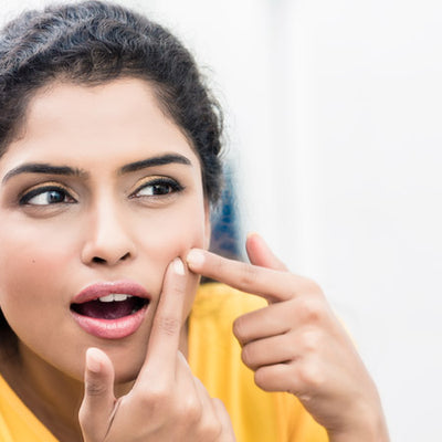 Skin Purging Or Acne? Know The Difference Before Opting For Treatments