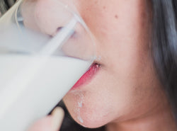 Is Milk Causing Your Acne? Ways To Find Out + Solutions