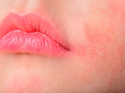 How Can You Prevent Rashes On Your Lips?