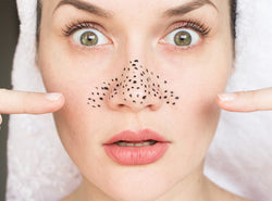 Oily Nose: Causes, Remedies & Prevention Tips