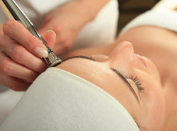 Is Microdermabrasion Good For Your Skin?