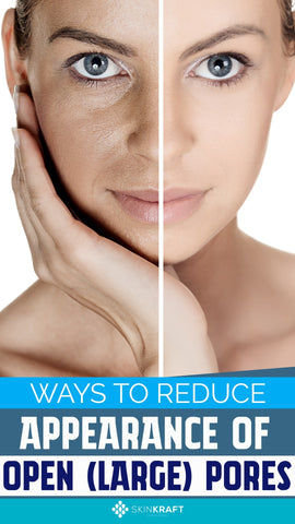 Ways To Reduce Appearance Of Open (Large) Pores