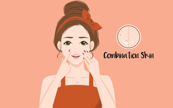 Combination Skin: What Exactly Is It And How To Manage It? – SkinKraft