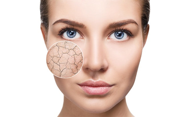 Dry Skin On The Face: Symptoms, Causes & Remedies