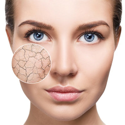 Dry Skin On The Face: Symptoms, Causes & Remedies